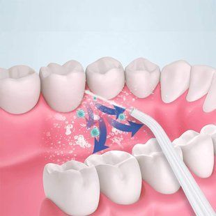 Іригатор для ротової порожнини 230 мл Portable Oral Irrigator 234562532 фото